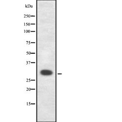Invitrogen ELF5 Polyclonal Antibody 100 &mu;L; Unconjugated:Antibodies,
