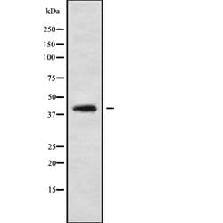 Invitrogen CABP1 Polyclonal Antibody 100 &mu;L; Unconjugated:Antibodies,