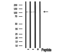 Invitrogen PDE2A Polyclonal Antibody 100 &mu;L; Unconjugated:Antibodies,