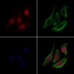 Invitrogen EEF1A2 Polyclonal Antibody 100 &mu;L; Unconjugated:Antibodies,