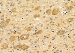 Invitrogen LRP4 Polyclonal Antibody 100 μL; Unconjugated:Antibodies,