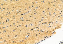 Invitrogen LRP4 Polyclonal Antibody 100 μL; Unconjugated:Antibodies,