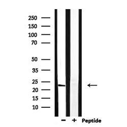 Invitrogen RAB13 Polyclonal Antibody 100 &mu;L; Unconjugated:Antibodies,