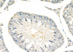 Invitrogen SH3GL3 Polyclonal Antibody 100 &mu;L; Unconjugated:Antibodies,