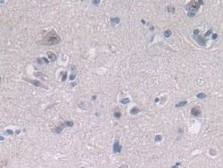 Invitrogen OAS2 Polyclonal Antibody 200 &mu;L; Unconjugated:Antibodies,