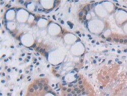 Invitrogen OAS2 Polyclonal Antibody 200 &mu;L; Unconjugated:Antibodies,