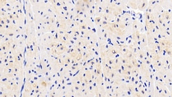 Invitrogen NT5M Polyclonal Antibody:Antibodies:Primary Antibodies