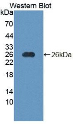 Invitrogen NT5M Polyclonal Antibody:Antibodies:Primary Antibodies