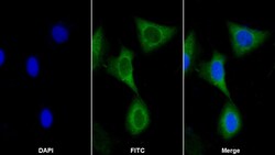 Invitrogen AKAP11 Polyclonal Antibody 200 &mu;L; Unconjugated:Antibodies,