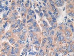 Invitrogen AKAP11 Polyclonal Antibody:Antibodies:Primary Antibodies