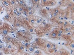 Invitrogen AKAP11 Polyclonal Antibody 200 &mu;L; Unconjugated:Antibodies,