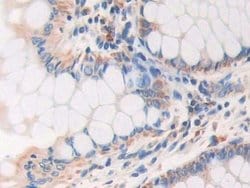 Invitrogen AKAP11 Polyclonal Antibody:Antibodies:Primary Antibodies