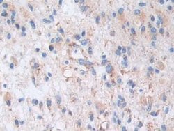 Invitrogen AKAP11 Polyclonal Antibody:Antibodies:Primary Antibodies
