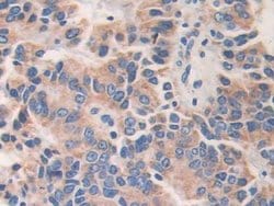 Invitrogen AKAP11 Polyclonal Antibody:Antibodies:Primary Antibodies