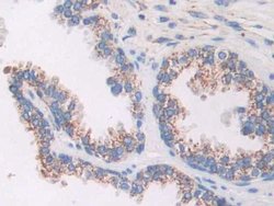 Invitrogen AKAP11 Polyclonal Antibody:Antibodies:Primary Antibodies