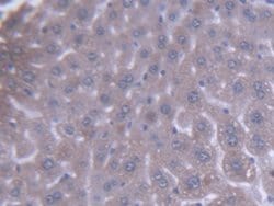 Invitrogen ACAA1 Polyclonal Antibody:Antibodies:Primary Antibodies