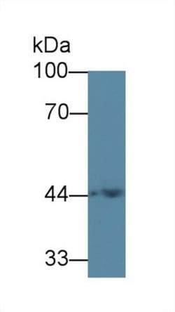 Invitrogen ACAA1 Polyclonal Antibody:Antibodies:Primary Antibodies