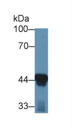 Invitrogen ACAA1 Polyclonal Antibody:Antibodies:Primary Antibodies