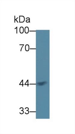 Invitrogen ACAA1 Polyclonal Antibody:Antibodies:Primary Antibodies