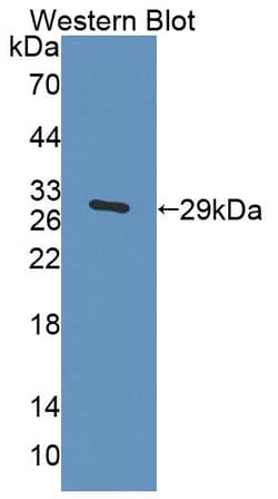 Invitrogen ACAA1 Polyclonal Antibody:Antibodies:Primary Antibodies