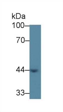 Invitrogen ACAA1 Polyclonal Antibody:Antibodies:Primary Antibodies