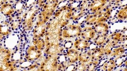 Invitrogen ACP1 Polyclonal Antibody:Antibodies:Primary Antibodies
