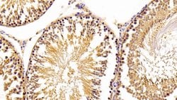 Invitrogen ACP1 Polyclonal Antibody:Antibodies:Primary Antibodies