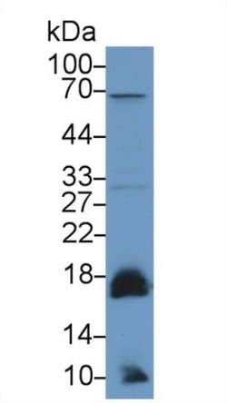 Invitrogen ACP1 Polyclonal Antibody:Antibodies:Primary Antibodies