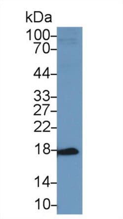Invitrogen ACP1 Polyclonal Antibody:Antibodies:Primary Antibodies