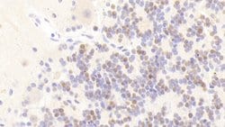 Invitrogen ANP32A Polyclonal Antibody 200 &mu;L; Unconjugated:Antibodies,
