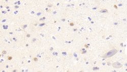 Invitrogen ANP32A Polyclonal Antibody 200 &mu;L; Unconjugated:Antibodies,