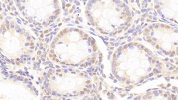 Invitrogen ANP32A Polyclonal Antibody 200 &mu;L; Unconjugated:Antibodies,