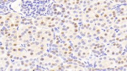 Invitrogen ANP32A Polyclonal Antibody 200 &mu;L; Unconjugated:Antibodies,