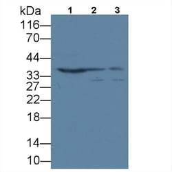 Invitrogen ANP32A Polyclonal Antibody:Antibodies:Primary Antibodies