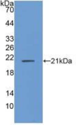 Invitrogen ANP32A Polyclonal Antibody 200 &mu;L; Unconjugated:Antibodies,