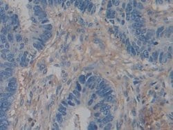 Invitrogen ACTG2 Polyclonal Antibody:Antibodies, Polyclonal
