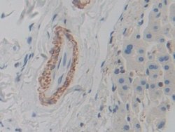 Invitrogen ACTG2 Polyclonal Antibody:Antibodies, Polyclonal