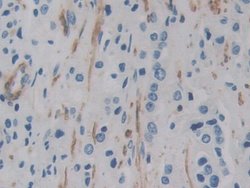 Invitrogen ACTG2 Polyclonal Antibody:Antibodies, Polyclonal