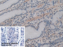 Invitrogen ACTG2 Polyclonal Antibody 20 &mu;L; Unconjugated:Antibodies,
