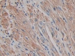 Invitrogen ACTG2 Polyclonal Antibody:Antibodies, Polyclonal