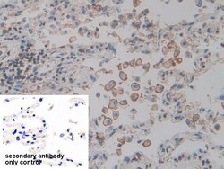 Invitrogen ACTG2 Polyclonal Antibody 20 &mu;L; Unconjugated:Antibodies,