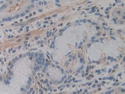 Invitrogen ACTG2 Polyclonal Antibody:Antibodies, Polyclonal