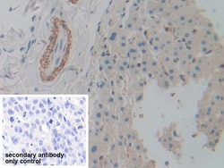 Invitrogen ACTG2 Polyclonal Antibody 20 &mu;L; Unconjugated:Antibodies,