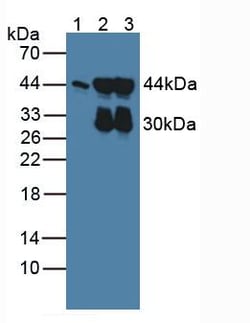 Invitrogen ACTG2 Polyclonal Antibody 20 &mu;L; Unconjugated:Antibodies,