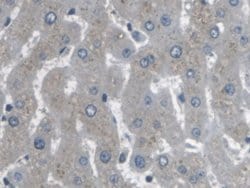 Invitrogen ARPC4 Polyclonal Antibody 200 &mu;L; Unconjugated:Antibodies,