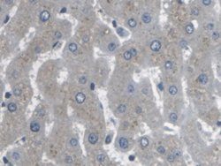 Invitrogen ARPC4 Polyclonal Antibody 200 &mu;L; Unconjugated:Antibodies,