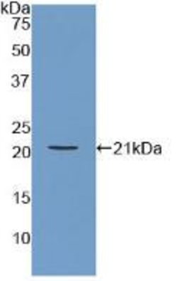 Invitrogen ARPC4 Polyclonal Antibody 200 &mu;L; Unconjugated:Antibodies,
