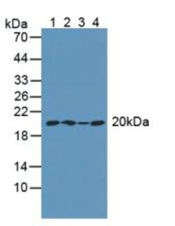 Invitrogen ARPC4 Polyclonal Antibody:Antibodies:Primary Antibodies