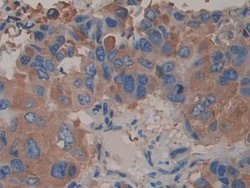 Invitrogen alpha Actinin 4 Polyclonal Antibody:Antibodies:Primary Antibodies