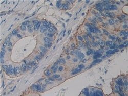 Invitrogen alpha Actinin 4 Polyclonal Antibody:Antibodies:Primary Antibodies